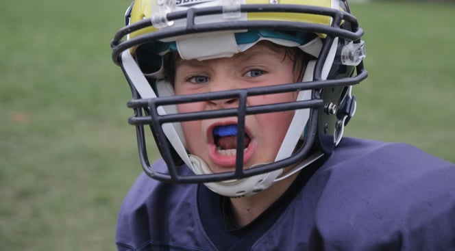 football mouthguard