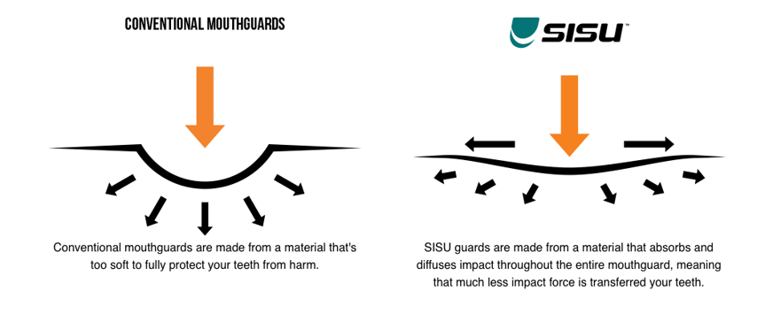 SISU Mouth guard Science