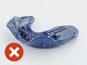 Mouthguard on an angle molded poorly.