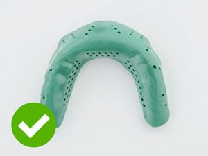 Mouthguard from overhead molded well.
